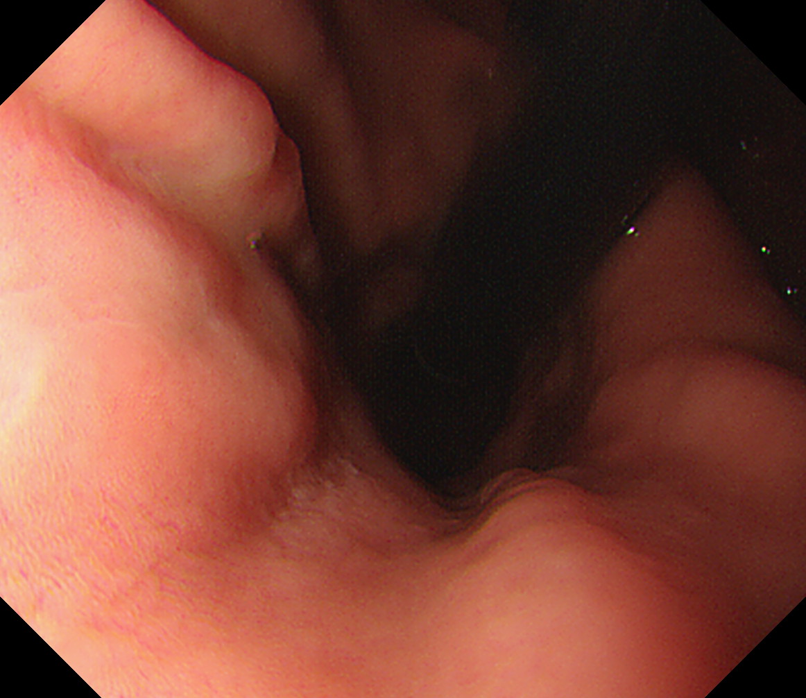 ���啔���^[�i���]]